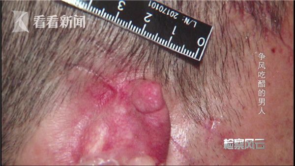 ��������ǧ�� ��ǰŮ�ѵ��������ѿ���Ѫ��