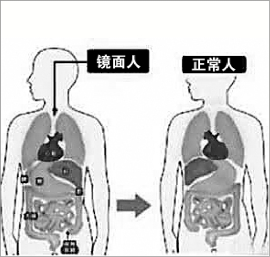 �����������������ų� Ϊ�������������Խת��